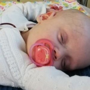 Gaja ma zaledwie 8 miesięcy. Jej maleńką główkę atakuje ekstremalnie rzadki rak