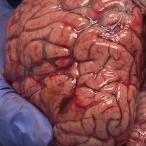 Neurobiolog na nagraniu demonstruje jak wygląda „świeży” mózg. Niewiarygodne jaki jest delikatny
