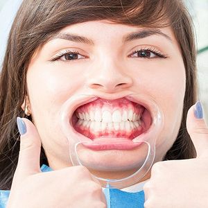 Nadchodzi koniec plomb. Nowy produkt może wyeliminować konieczność wizyty u dentysty