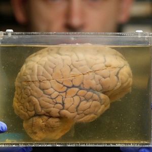 Naukowcy wyhodowali mini-mózgi, których wzorce do złudzenia przypominają aktywność u wcześniaków