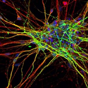 Badanie sugeruje, że komórki nerwowe osób z autyzmem rozwijają się znacznie szybciej i są większe