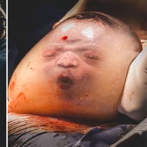 Każdy zna powiedzenie „w czepku urodzony”. Tak wygląda dziecko w nienaruszonym worku owodniowym