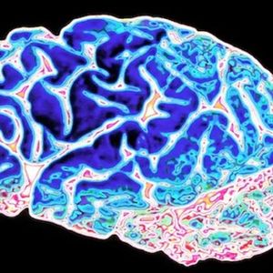 Nowe badanie krwi może wykryć chorobę Alzheimera na długo przed pojawieniem się objawów