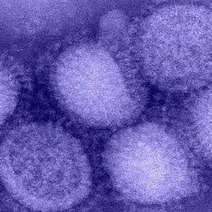 W Kanadzie zgłoszono pierwszy przypadek rzadkiego wariantu grypy H1N2 u człowieka