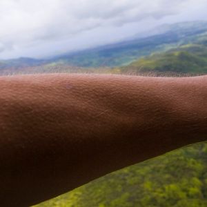 Niektórzy są w stanie wywołać gęsią skórkę na żądanie, co jest absolutnie osobliwą cechą