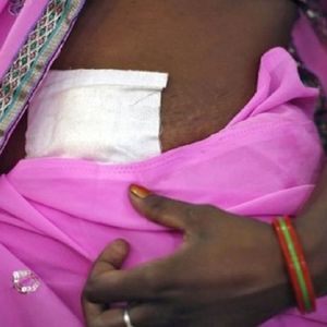 Indie walczą z przeludnieniem. Kraj planuje wprowadzenie dobrowolnej sterylizacji i ulg podatkowych