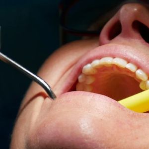 Zdarza ci się zgrzytać zębami i zaciskać szczękę? Nawyk jest szkodliwy i warto się go pozbyć