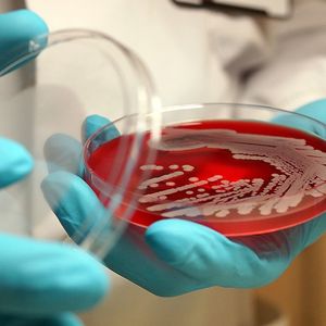 Główną przyczyną zgonów na całym świecie są superbakterie oporne na antybiotyki