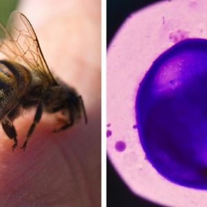 Jad pszczeli okazuje się niezwykle skuteczny w zabijaniu agresywnych komórek raka piersi