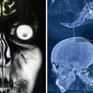 Zdjęcia rentgenowskie, które nauczą cię więcej o ludzkim ciele niż podręczniki do biologii