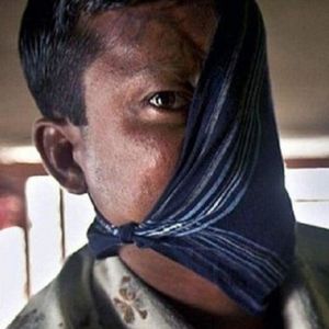 20 lat po ataku tygrysa, mężczyzna w końcu zdecydował się na pokazanie swojej okaleczonej twarzy