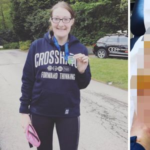 Brała udział w 21-godzinnym maratonie. Kiedy w domu zdjęła spodenki, stan jej nóg był krytyczny