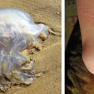 Niebezpieczne meduzy pojawiły się w Bałtyku. W weekend zostało poparzonych 90 osób