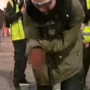 Granat urwał dłoń demonstrantowi z Francji. Nagranie z miejsca zdarzenia wstrząsnęło światem