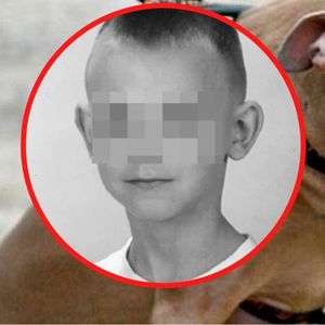 12-letni Kamil został zagryziony przez pitbulla. Właściciel usłyszał zarzuty