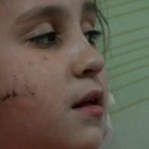 rosyjski żołnierz strzelił w twarz dziewczynce