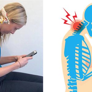 Częste korzystanie z telefonu rujnuje Twoją szyję! Powoduje ból i garb do końca życia