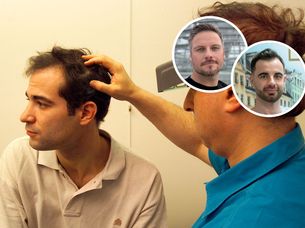Komórki macierzyste, terapie genowe i laseroterapia. Nowe technologie w walce z łysieniem