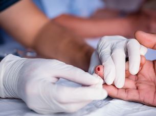 Anonimowe i darmowe testy na HIV