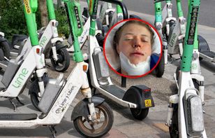 Miała wypadek na hulajnodze elektrycznej. "Chciałam umrzeć