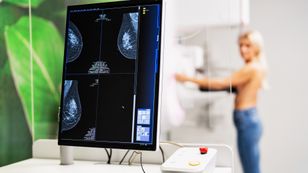 "Nic nie boli" to pułapka, w którą wpada większość Polaków. Jak przejść przez profilaktykę onkologiczną z planem i bez stresu