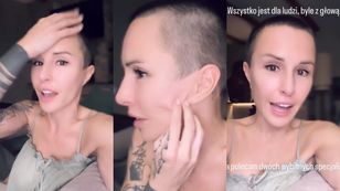 Blanka Lipińska ŻAŁUJE zabiegów medycyny estetycznej. "Lifting nie wygląda tak, jak powinien. Ale profesor i tak URATOWAŁ MI TWARZ"