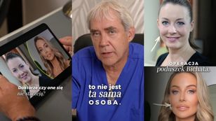 Doctor says Małgorzata Rozenek looks like a completely different person after procedures