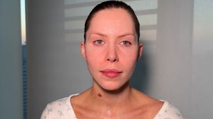 Tak wyglądała Julia von Stein, zanim zdecydowała się na operacje plastyczne (STARE ZDJĘCIA)