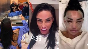 U Katie Price bez zmian. Pokazała twarz całą w opatrunkach, relacjonując kolejną operację w tureckiej klinice