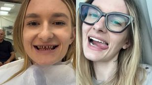 Joanna z "Rolnik szuka żony" pognała do Turcji po nowe zęby. W Polsce jest za drogo