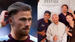 Matty Cash pochwalił się PRZESZCZEPEM WŁOSÓW (FOTO)