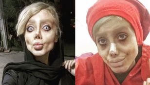Przeszła 50 operacji i schudła 40 kg, żeby wyglądać jak Angelina Jolie. Skończyła w irańskim WIĘZIENIU