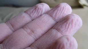 Zmarszczki na palcach po kąpieli. Co mówią o naszym zdrowiu?