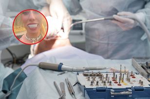 Influencerka zrobiła zęby w Turcji. Pokazała, jak teraz wygląda