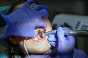 French clinic removes teen's wisdom teeth instead of operating on her ankle