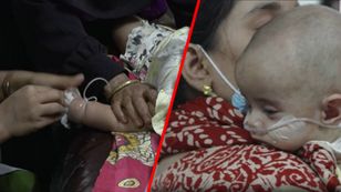 100 dzieci nie żyje. Epidemia odry w Bangladeszu