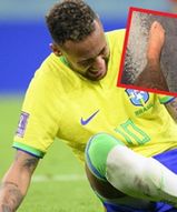 Neymar pokazał nowe zdjęcia po kontuzji. Tak wygląda jego kostka