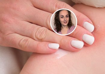 Pieluszkowe SOS. Jak radzić sobie z odparzeniami i dbać o wrażliwą skórę niemowlaka?