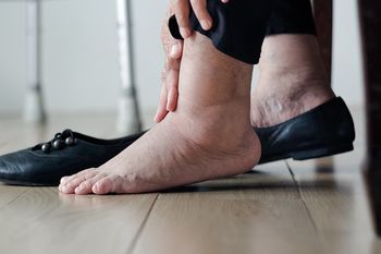 Spuchnięte stopy latem? Ten japoński sposób poradzi sobie w mig