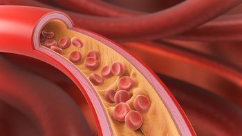Hipercholesterolemia na talerzu: co naprawdę zmienia dietę?
