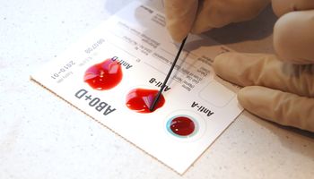 Sprawdź, jaki wpływ na Twoje życie ma grupa krwi. 10 fascynujących faktów!