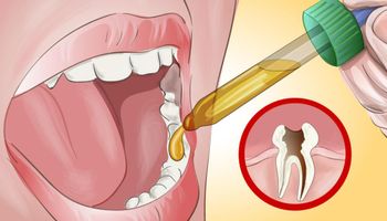 Poznaj domowy sposób na ból zęba. Pomoże Ci uśmierzyć ból do czasu wizyty u dentysty