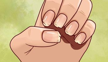 Jeżeli łamią Ci się paznokcie i wypadają włosy, Twój organizm może upominać się o coś bardzo ważnego