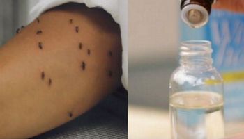 Natrętne komary nie dają spokoju… Ale z tym naturalnym sprayem pozbędziesz się ich na długo!