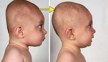 4 ważne wskazówki, które pomogą Ci zapobiec spłaszczeniu główki u niemowlaka. Nie ignoruj tego!