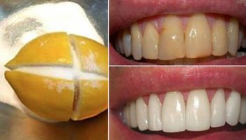 Wybielić zęby można nie tylko u dentysty. Okazuje się, że zwykła cytryna wystarczy