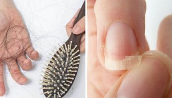 Naturalne składniki pomagające w walce z wypadającymi włosami i łamliwymi paznokciami
