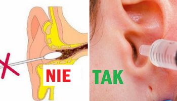 Kilka sprawdzonych sposobów, dzięki którym bezpiecznie usuniesz zalegającą w uszach woskowinę