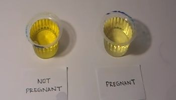 Banalnie proste domowe testy ciążowe. Możesz się zdziwić, ale okazują się być skuteczne