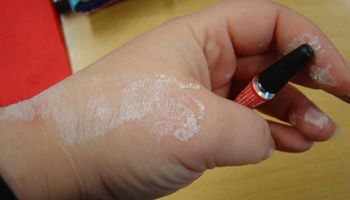 Ten trik pomoże skutecznie usunąć klej Super Glue ze skóry. Nigdy nie próbuj oderwać go na siłę